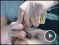 Das Wunder von Kärnten Trailer