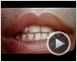 Videodrome Trailer OV